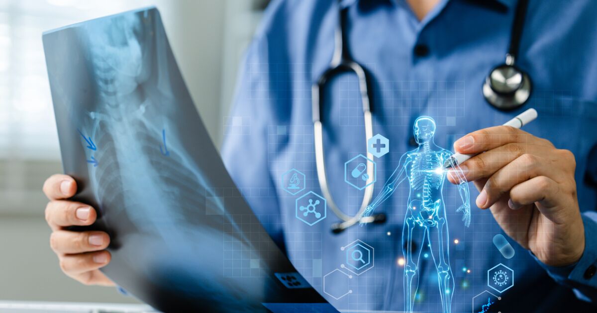 Inteligencia artificial busca reducir el déficit de fisioterapeutas en méxico