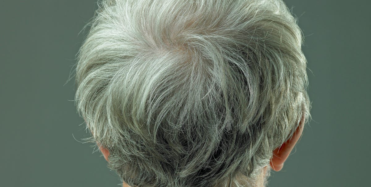 NYU Researchers Identify Stem Cell Mobility as Key to Reversing Hair Graying