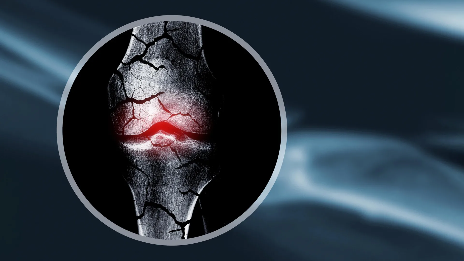 PFAS Chemicals Linked to Lower Adolescent Bone Density in New Study